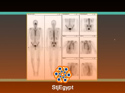 Crash Course in Nuclear Medicine for Radiology Exam Preparation