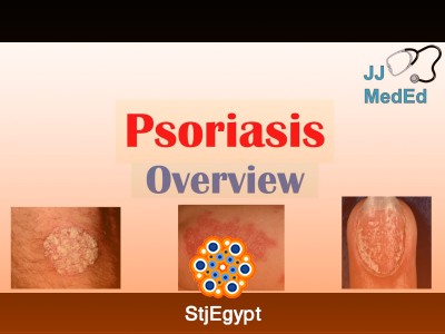 Common Skin Diseases Overview (Dermatology Essentials Course)