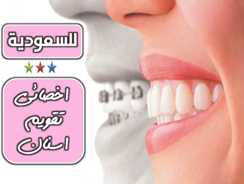 للتعاقد الفوري مطلوب اخصائي تقويم اسنان لمستشفى كبرى بالسعودية - STJEGYPT